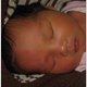 Illustration for article titled This is Why Some Newborn Babies Turn Half-Red